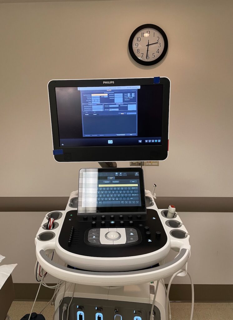 Annual Heart Transplant Check-Up - Machine used for echocardiogram